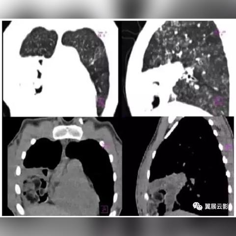 独家揭秘！快速掌握空洞骑士丝之歌念珠炮获取技巧，轻松升级战斗力