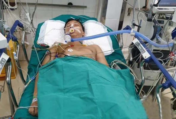 英国游客土耳其遇车祸，生命垂危医院紧急呼吁器官捐献挽救生命