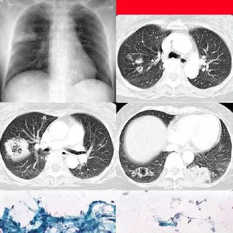 《空洞骑士》丝之歌念珠炮获取攻略：独家技巧助你轻松入手！