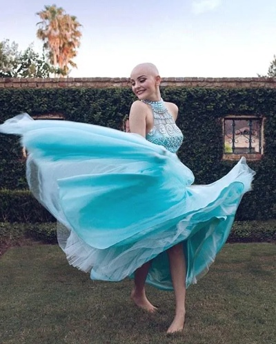 27岁写真女星抗癌离世，绽放生命新光彩——天使陨落