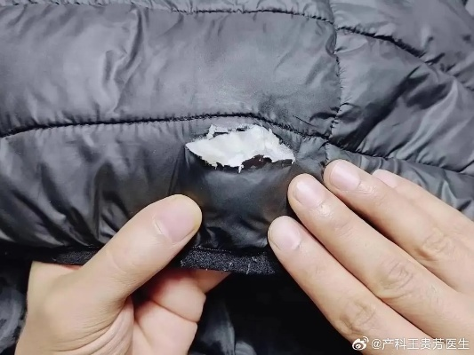 羽绒肺风险警示：羽绒服穿错易伤肺，警惕羽绒危害